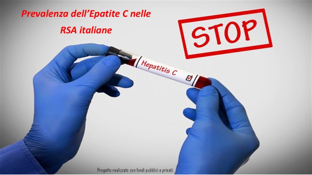 RSA italiane, prevalenza dell'Epatite C: progetto della Fondazione Policlinico Universitario Campus Biomedico di Roma